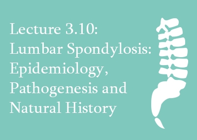 3.10 Lumbar Spondylosis: Epidemiology, Pathogenesis and Natural History