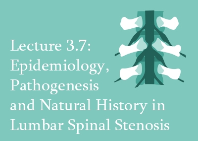 3.7 Lumbar Spinal Stenosis