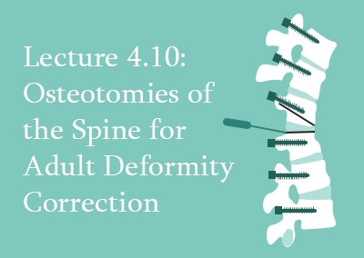 4.10 Osteotomies of the Spine for Adult Deformity Correction
