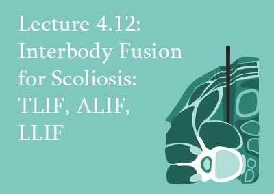 4.12 Interbody Fusion for Scoliosis: TLIF, ALIF, LLIF