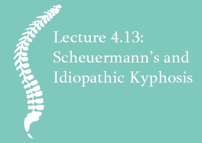 4.13 Scheuermann’s and Idiopathic Kyphosis – Clinical Presentation and Natural History