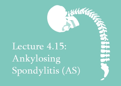 4.15 Ankylosing Spondylitis (AS)