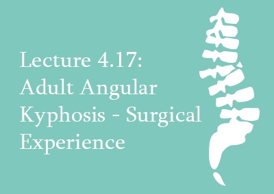 4.17 Adult Angular Kyphosis Surgical Treatment