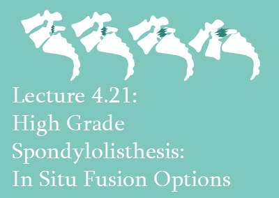 4.21 High Grade Spondylolisthesis: In Situ Fusion Options