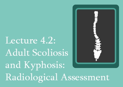 4.2 Adult Scoliosis and Kyphosis Radiological Assessment
