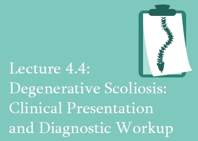 4.4 Degenerative Scoliosis: Clinical Presentation and Diagnostic Workup