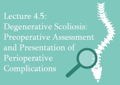 4.5 Degenerative Scoliosis Preoperative Assessment and Prevention of Perioperative Complications