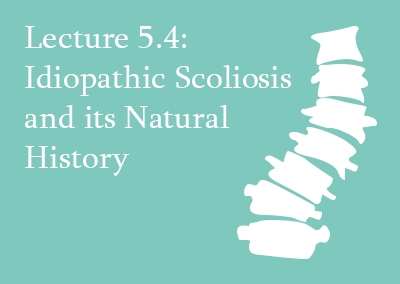 5.4 Idiopathic Scoliosis and Its Natural History