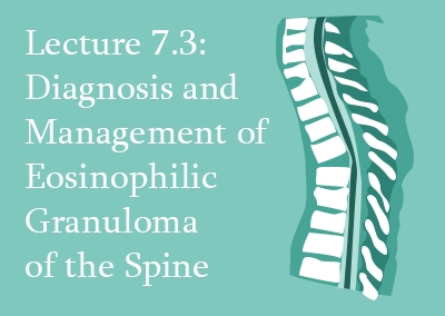 7.3 Diagnosis and management of Eosinophilic Granuloma of the spine