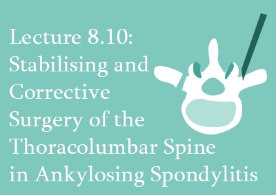 8.10 Stabilising and Corrective Surgery of the Thoracolumbar Spine in Ankylosing Spondylitis