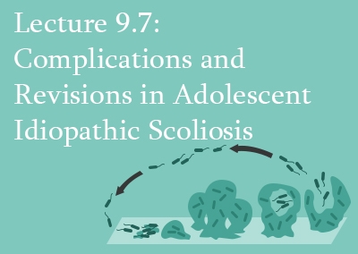 9.7 Complications and Revisions in Adolescent Idiopathic Scoliosis