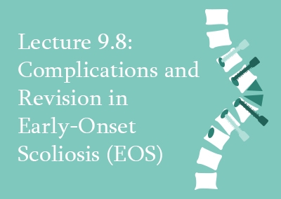 9.8 Complications and Revision in Early-Onset Scoliosis (EOS)