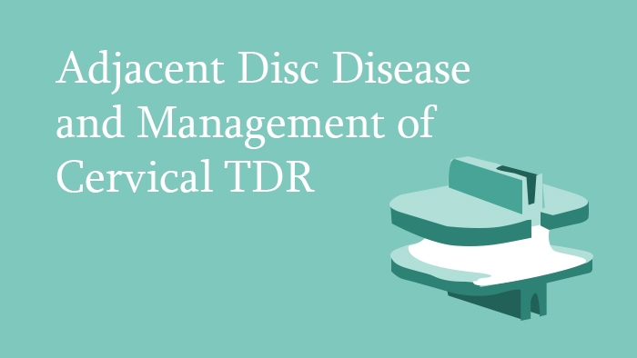 Management of Cervical Total Disc Replacement Lecture Thumbnail