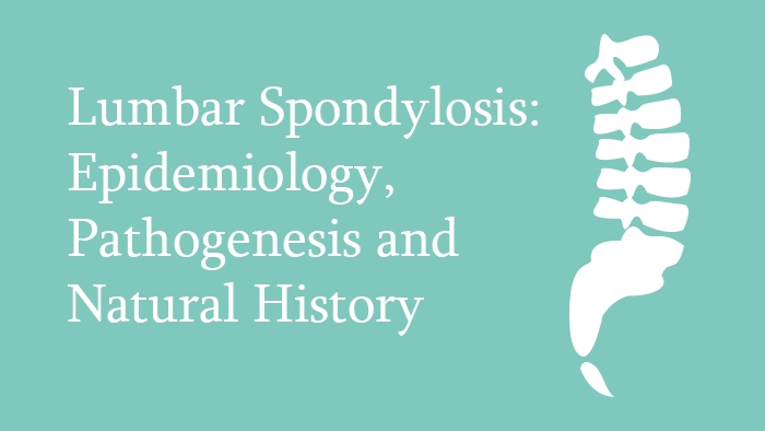 Lumbar Spondylosis - Spine Surgery Lecture - Thumbnail