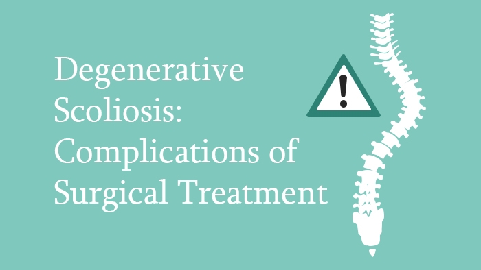 Degenerative Scoliosis: Clinical Presentation and Diagnostic Workup Lecture Thumbnail