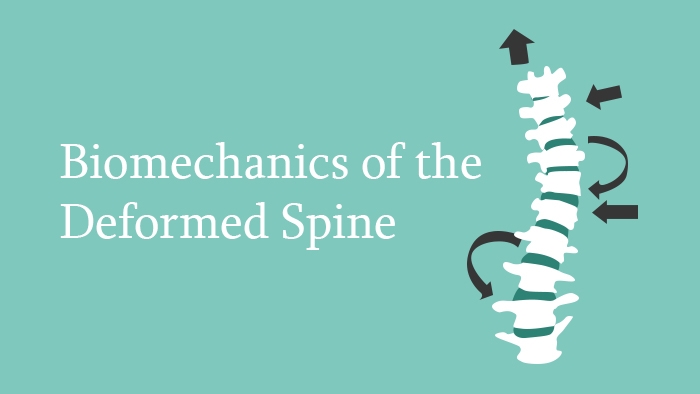 Biomechanics of the Deformed Spine Lecture Thumbnail