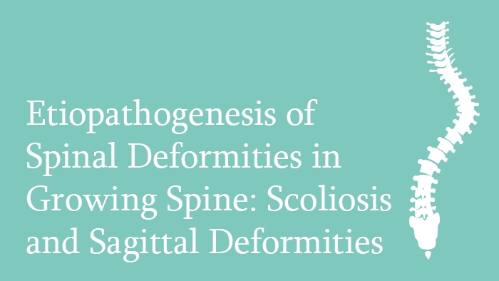 Etiopathogenesis of Spinal Deformities in Growing Spine: Scoliosis and Sagittal Deformities Lecture Thumbnail