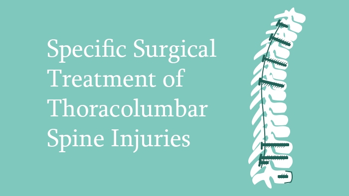 Surgical Treatment of Thoracolumbar Spine Injuries - Spine Surgery Lecture - Thumbnail