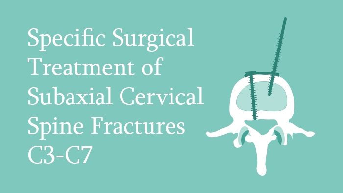 Specific Surgical Treatment of Subaxial Cervical Spine Fractures C3-C7 Lecture Thumbnail