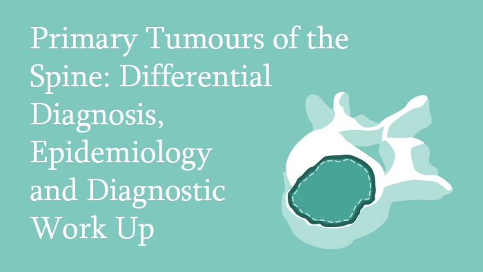 Primary Tumours of the Spine: Differential Diagnosis, Epidemiology and Diagnostic Work Up Lecture Thumbnail