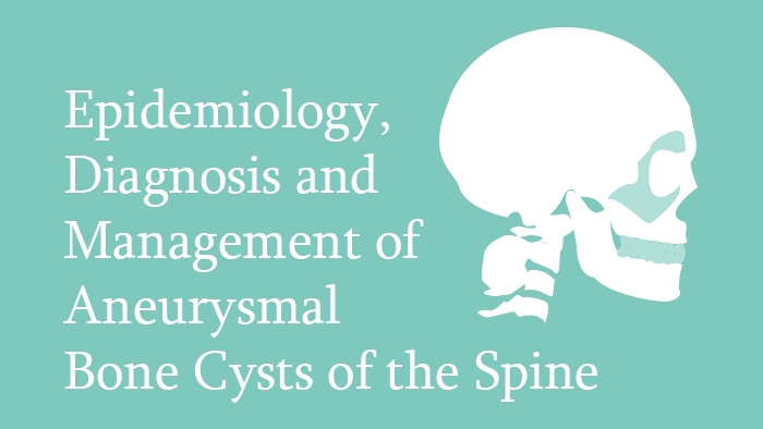 Epidemiology, Diagnosis and Management of Aneurysmal Bone Cysts of the Spine Module Thumbnail