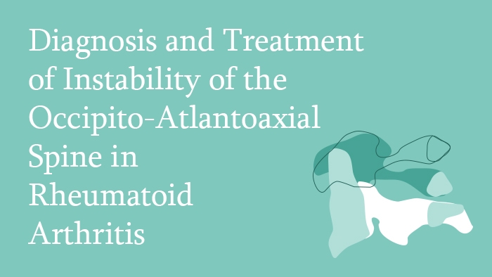 Diagnosis and Treatment of Instability of the Occipito-Atlantoaxial Spine in Rheumatoid Arthritis Lecture Thumbnail