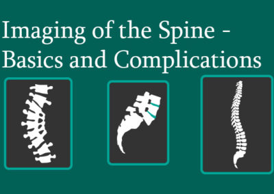 Imaging of the Spine – Basics and Complications