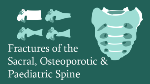 Fractures of the Sacral, Osteoporotic & Paediatric Spine