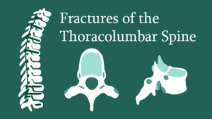 Fractures of the Thoraco-lumbar Spine