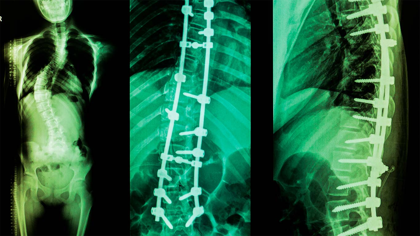 Image of Spine Surgeons performing an operation